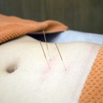 Akupunktura- na co pomaga?